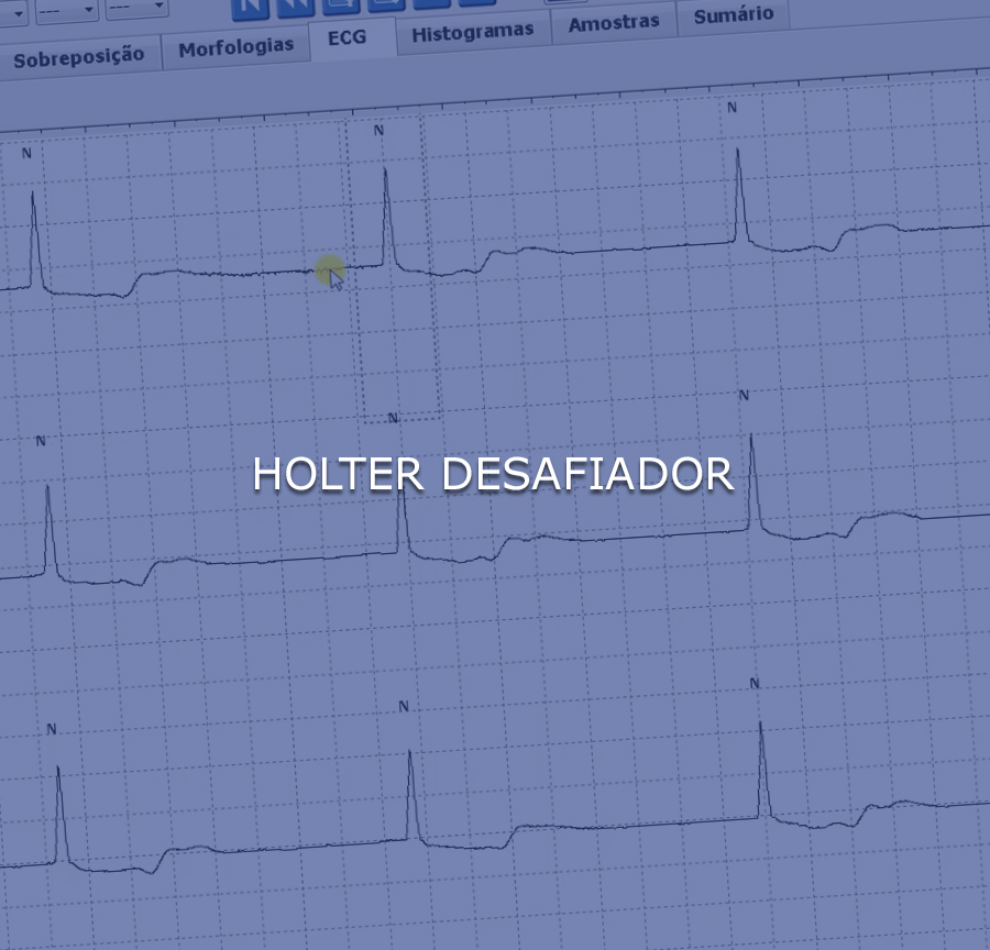 Holter Desafiador - TME - Telemedicina Cardiológica